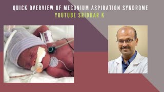 Quick overview of Meconium aspiration syndrome Meconiumaspiration pneumonia neonatology [upl. by Jemmie]