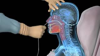 How to insert a nasogastric tube for NG intubation  3d animation [upl. by Hollerman400]