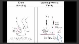 AFO  Ankle Foot Orthosis  Fall Prevention  Foot Drop [upl. by Hamaso]