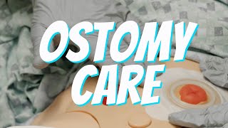 Colostomy and Ileostomy Care and Bag Change  Nurse Skill Demo [upl. by Tiertza184]