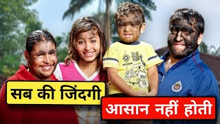 क्योंकि जीना इसी का नाम है worlds Hairiest family Gomez Family Hypertrichosis Disorder in hindi [upl. by Anahgem]