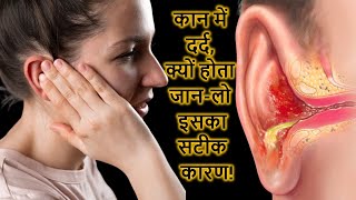 कान में दर्द के कारण और इलाज  Causes And Treatment Of Ear Pain [upl. by Su]