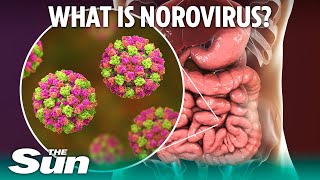 What is norovirus and how long does sickness bug last [upl. by Donohue943]