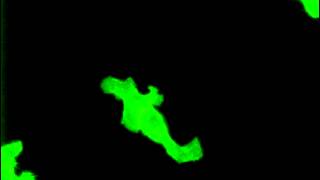 Aneously firing neurons observed using FluoVolt™ Membrane Potential Dye [upl. by Maltzman]