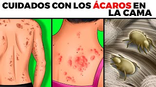 ÁCAROS EN LA CAMA alergias peligros cómo se mira en tu piel cómo eliminarlos y prevenirlos [upl. by Christan]