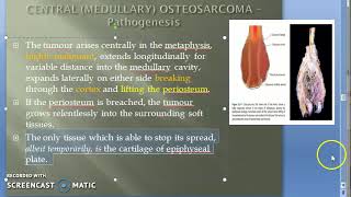 Pathology 828 c OsteoSarcoma Pathogenesis Clinical Metaphysis Bone ALP Sunburst Pattern Codman [upl. by Idahs]