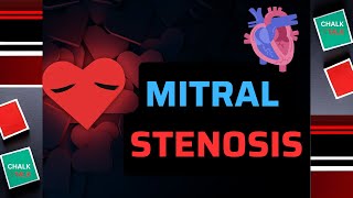 Mitral Valve Stenosis [upl. by Matthias]