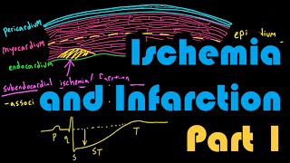 Ischemia Infarction and the Waveforms Q through U Part 1 How to Read an EKG Curriculum [upl. by Harrat]