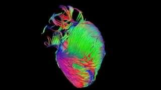 Diffusion tensor imaging via MRI of the heart [upl. by Rovert170]