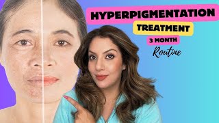 Hyperpigmentation treatment at home  Nipun Kapur [upl. by Demitria758]