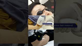 3 tips for using this diode laser hair removal machine [upl. by Hazeefah]