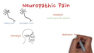 Neuropathic pain [upl. by Anitsirhk]