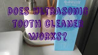 Ultrasonic Tooth Cleaner  Does It Work Honest Review [upl. by Kazimir]