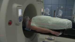 Having Radiotherapy for Brain Cancer [upl. by Spiers3]