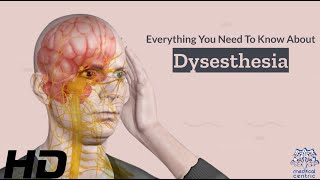 Dysesthesia 101 A Comprehensive Guide to this Mysterious Condition [upl. by Olgnaed39]