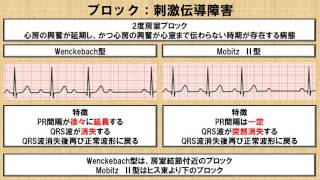 不整脈に対する心電図の読み方 ～No17 理学療法士国家試験対策 シリーズ～ [upl. by Oniskey]