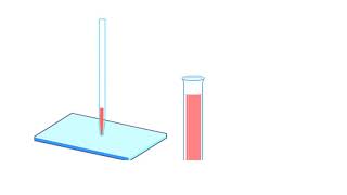 A Human Karyotype Preparation Animation [upl. by Esidnac448]