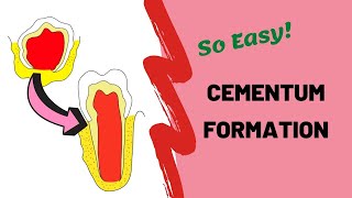 What is Cementum [upl. by Shelah]