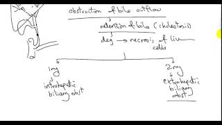 BILIARY CIRRHOSIS DR SAMEH GHAZY [upl. by Maris]