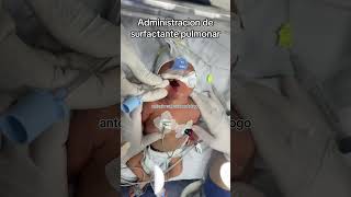 Administración de surfactante pulmonar 12 🫀🫁👶🏻 [upl. by Animsaj99]