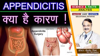 APPENDICITIS क्या है कारण   WHAT CAUSES APPENDICITIS [upl. by Gibeon]