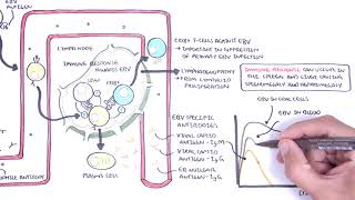 Epstein Barr Virus and Infectious Mononucleosis pathophysiology investigations and treatment [upl. by Ritz]