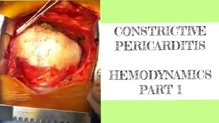 Constrictive pericarditis hemodynamics  1 [upl. by Craw]