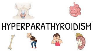 Hyperparathyroidism Primary Secondary and Tertiary  Simple and easy to understand [upl. by Nwahsav184]