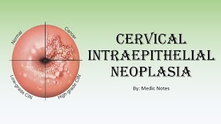 OampG Cervical intraepithelial neoplasia  for medical students [upl. by Savihc]