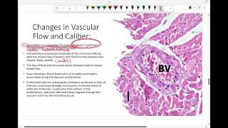 Intro to pathology tissue inflammation 2 [upl. by Idas]