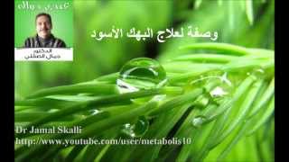 وصفة لعلاج البهك الأسود [upl. by Aratihc819]