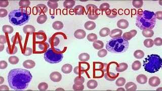 How to WBC count under Microscope [upl. by Yzeerb800]