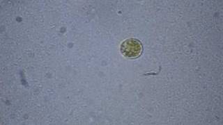 Dinoflagellate Swims the Salt Pond [upl. by Rubie]