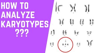 How to Analyze Karyotypes 101 [upl. by Eseneg468]