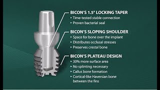 Introduction to Bicon SHORT® Implants HD [upl. by Wieche]