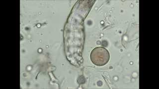 Help een demodex mijt [upl. by Anelram]