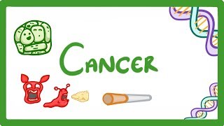 GCSE Biology  What is Cancer Benign and Malignant Tumours Explained 43 [upl. by Sitnik]