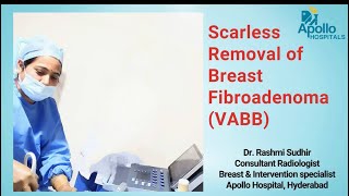 Scarless removal of breast fibroadenoma vacuumassistedbreastbiopsy vabb rashmisudhir9869 [upl. by Latona]