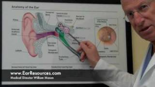 quotTreatable Causes of Hearing Lossquot Hearing Loss Newton MA Part 2 [upl. by Deland]