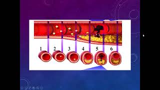 Cardiopatía isquémica II  AngioCardiología  sem 6 [upl. by Daffy]