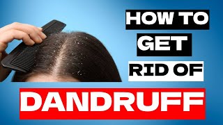 How to Get Rid of Dandruff Quickly  Medicated Shampoos For Seborrheic Dermatitis [upl. by Janeczka]