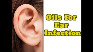 10 Best Essential Oils For Ear Infection  Boldsky [upl. by Oren]