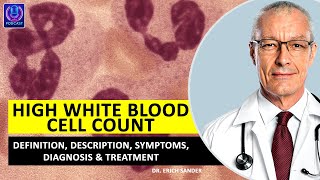 HIGH WHITE BLOOD CELL COUNT LEUKOCYTOSIS What is What is leukocytosis Definition of leukocytosis [upl. by Siron]