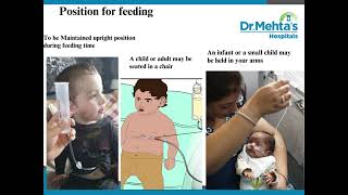 Button Gastrostomy Feeding [upl. by Tirreg]