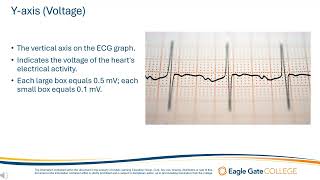 The ECG Graph [upl. by Engleman]