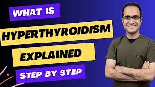 Hyperthyroidism Graves Disease Symptoms Diagnosis Wolff Chaikoff Effect Medicine Lecture USMLE [upl. by Icrad]