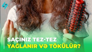 Saçınız teztez yağlanır və tökülür DİQQƏT  Elə çarə 27022024 [upl. by Rosella557]