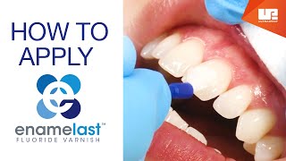 How to apply Enamelast™ Fluoride Varnish  StepbyStep [upl. by Ceporah]