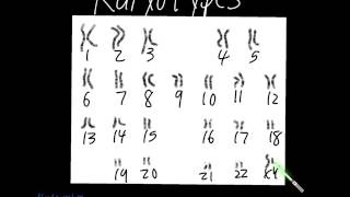 Karyotypes and Nondisjunction Made Easy [upl. by Adnwahsat]