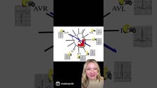 12 Lead ECG interpretation Part 1 [upl. by Neerehs]